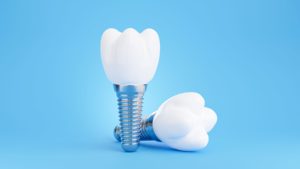 Two large model dental implants on a light blue background