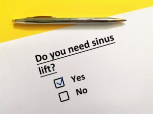 Paper that reads "do you need a sinus lift."