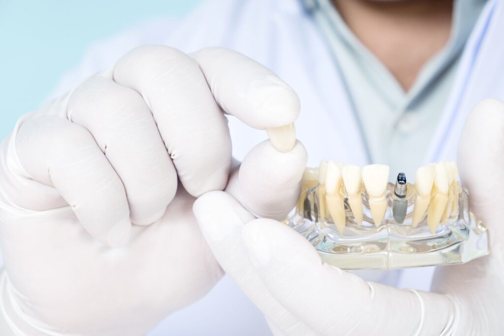 Dentist in white holding sample dental implant