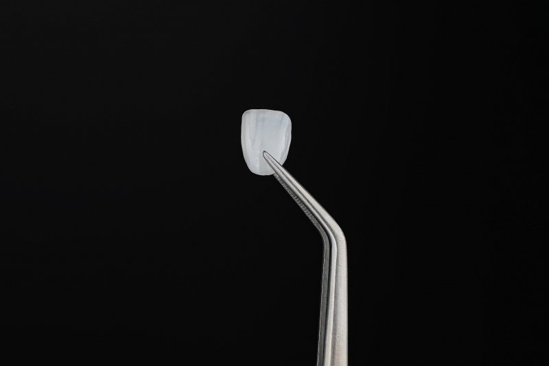 Veneer held with tweezers